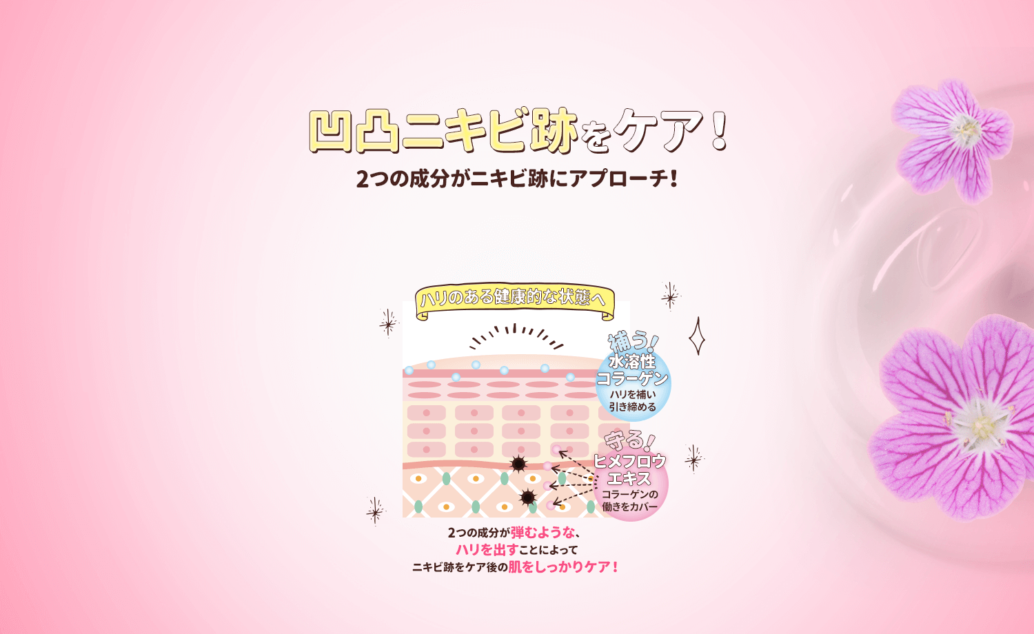 凹凸ニキビ跡をケアしてつるすべに 3つの成分がニキビ跡にアプローチ!