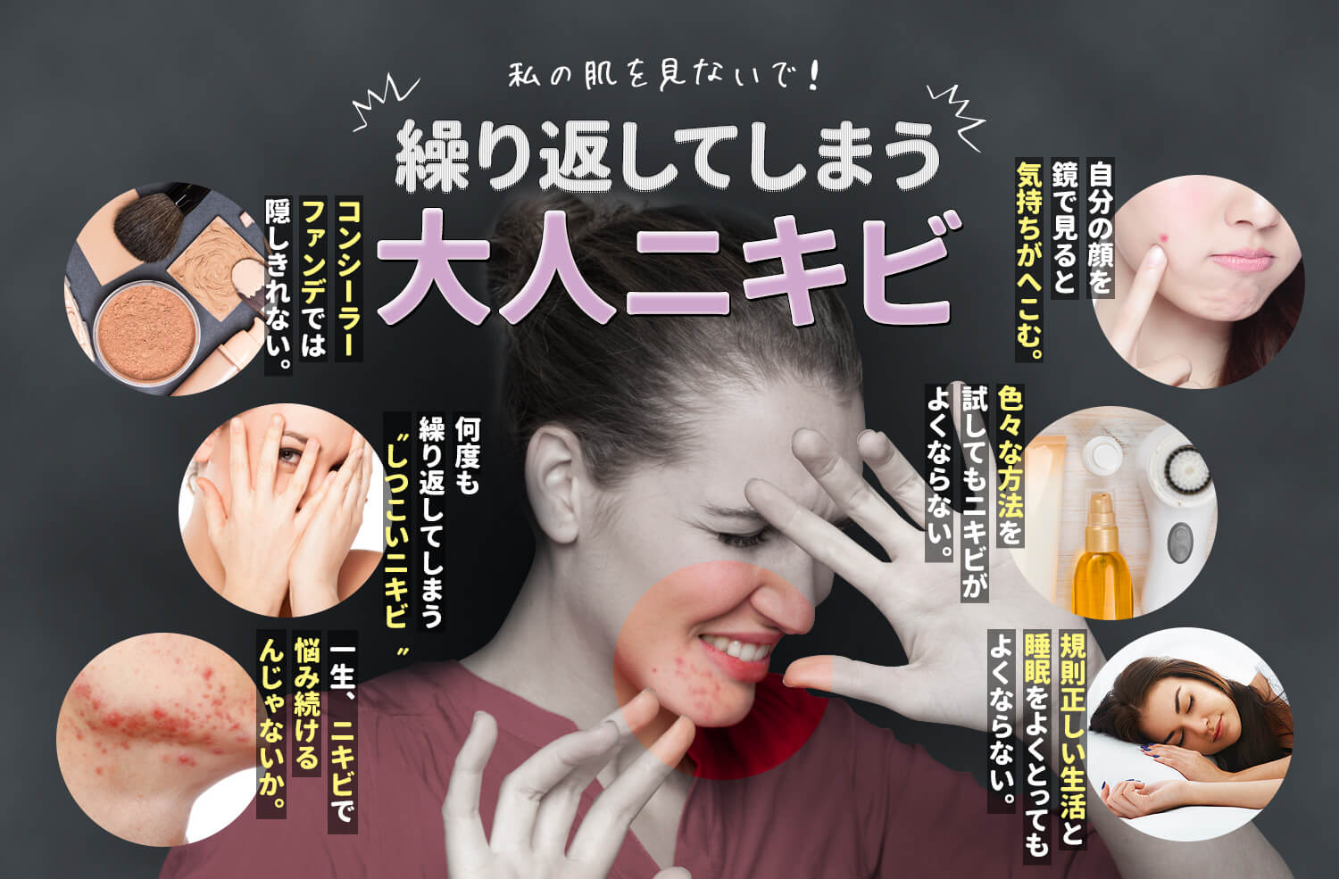 繰り返してしまう大人ニキビ