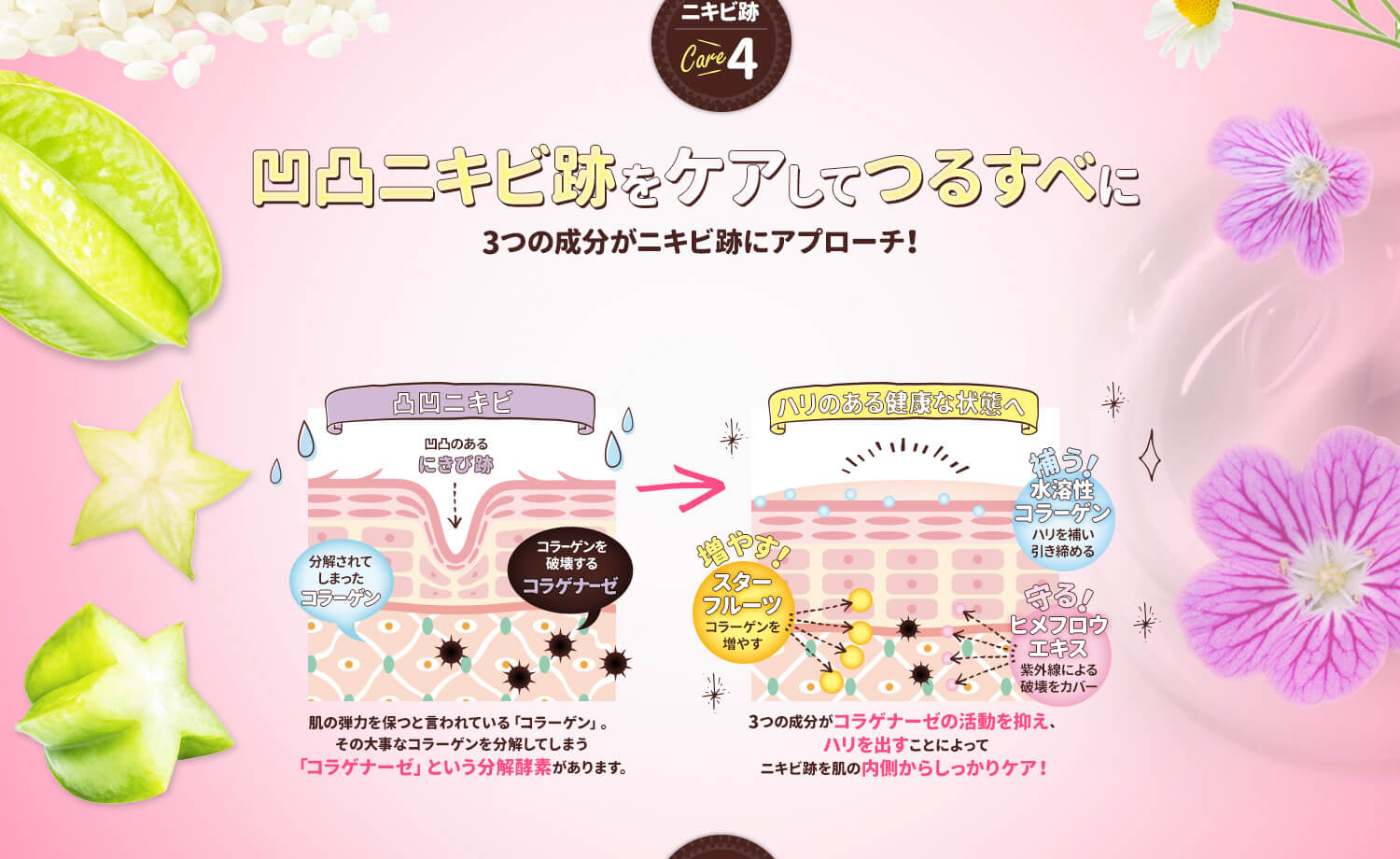 凹凸ニキビ跡をケアしてつるすべに 3つの成分がニキビ跡にアプローチ!