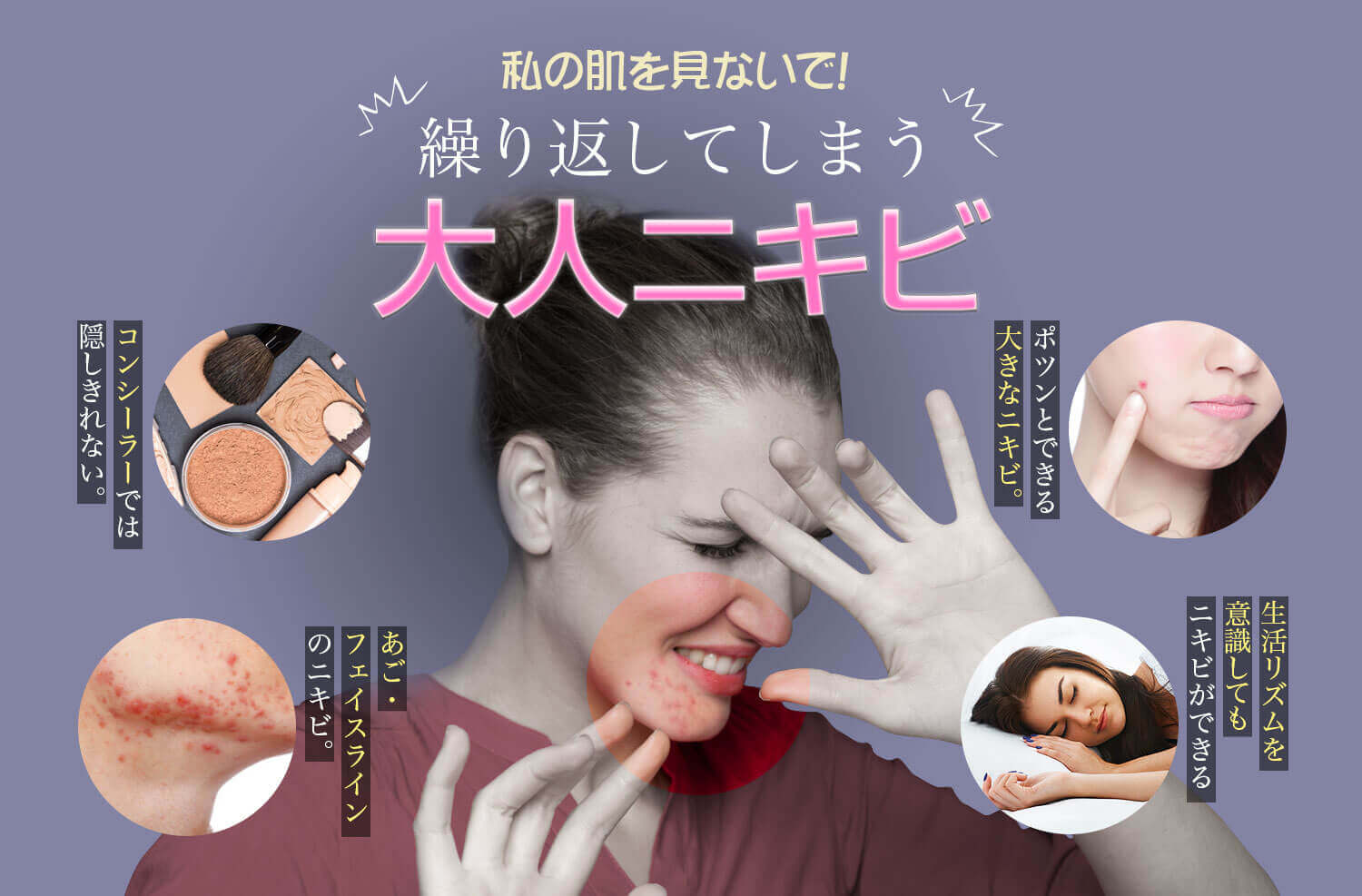 繰り返してしまう大人ニキビ