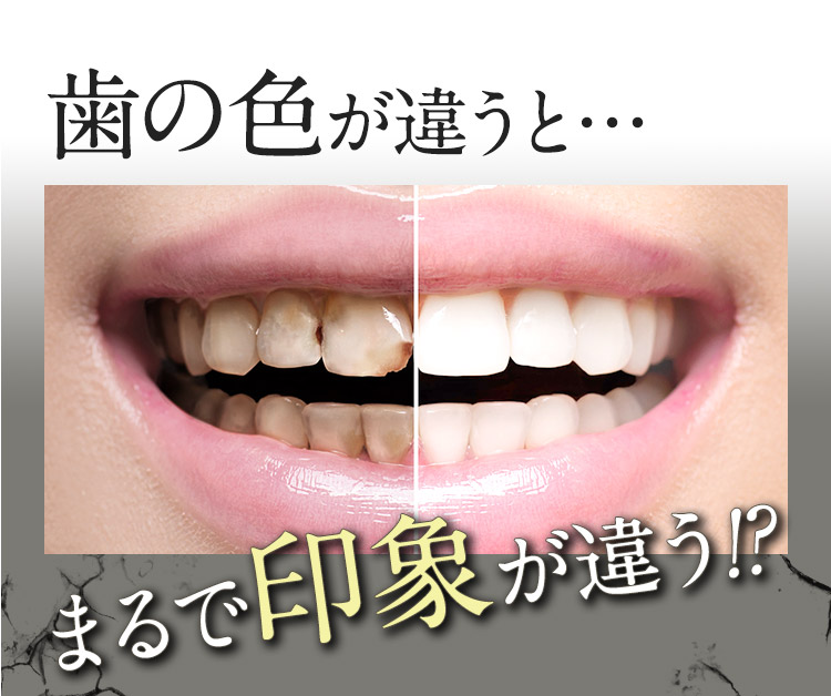 歯の色が違うとまるで印象が違う!?