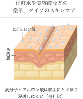 貼るだけでヒアルロン酸注入 翌朝驚きのハリ肌を実感 ダーマフィラープレミア 定期8回分セット 貼るだけでヒアルロン酸注入 翌朝驚きのハリ肌を実感 ダーマフィラープレミア 定期8回分セット