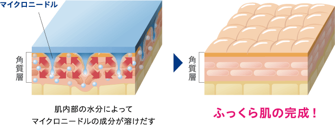 肌内部の水分によってマイクロニードルの成分が溶けだす