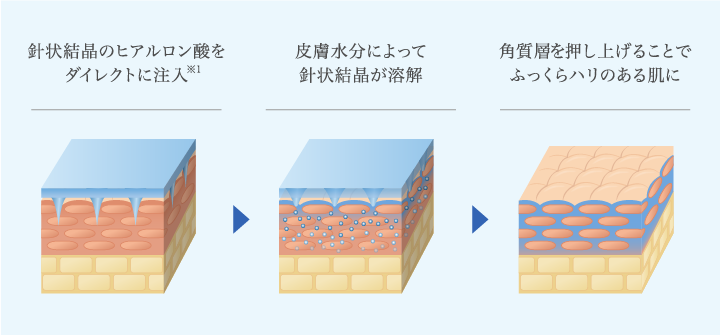 「すべて溶ける」自己溶解型パッチ