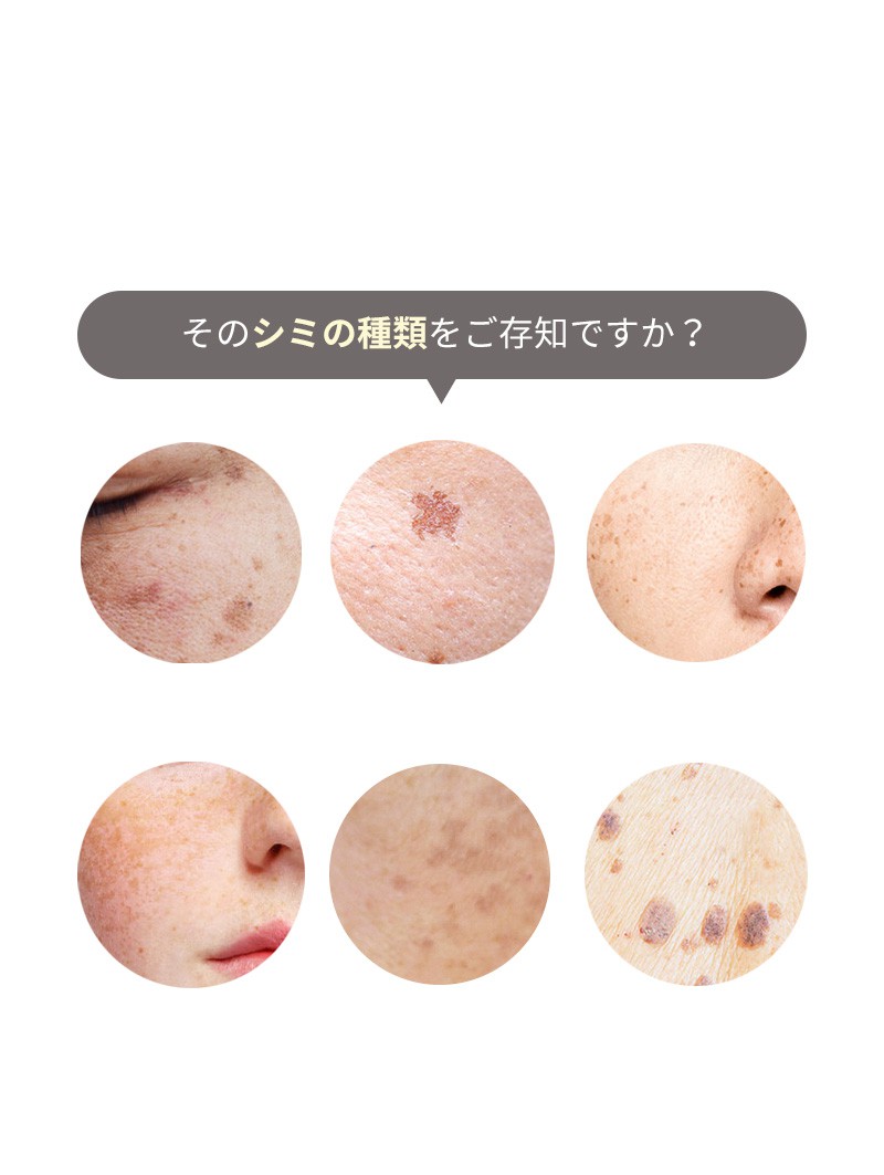 そのシミに合ったケアを知らないから!