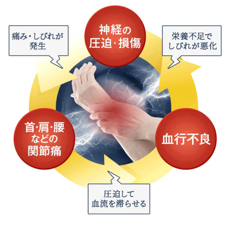 手足のしびれの薬 アユミンs 公式