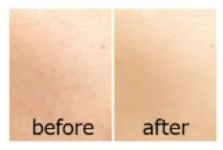 before/after