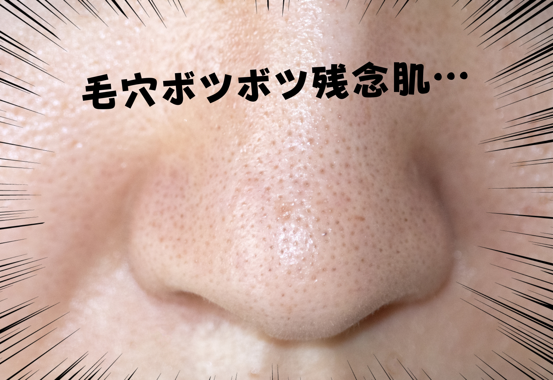 感激 長年のガンコな毛穴汚れがトロトロ 脱 毛穴残念系女子 でつるんと肌をゲット