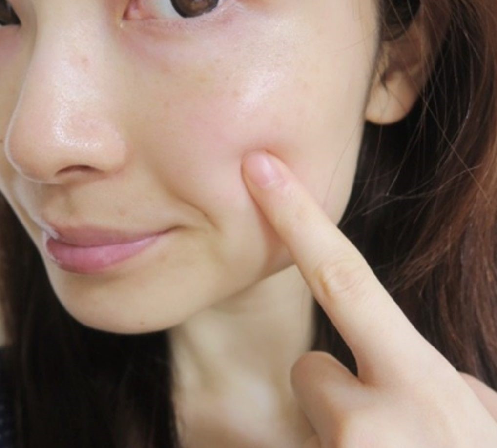 感激 長年のガンコな毛穴汚れがトロトロ 脱 毛穴残念系女子 でつるんと肌をゲット