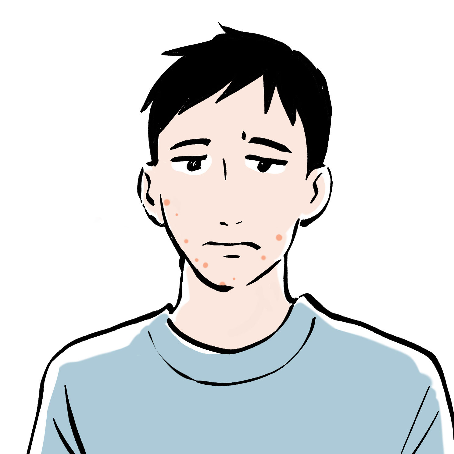 ニキビ