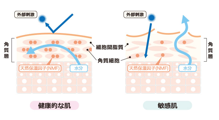 敏感肌の肌状態