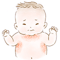首・関節周りの肌トラブルを抱える赤ちゃんのイラスト