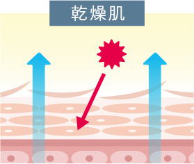 乾燥肌