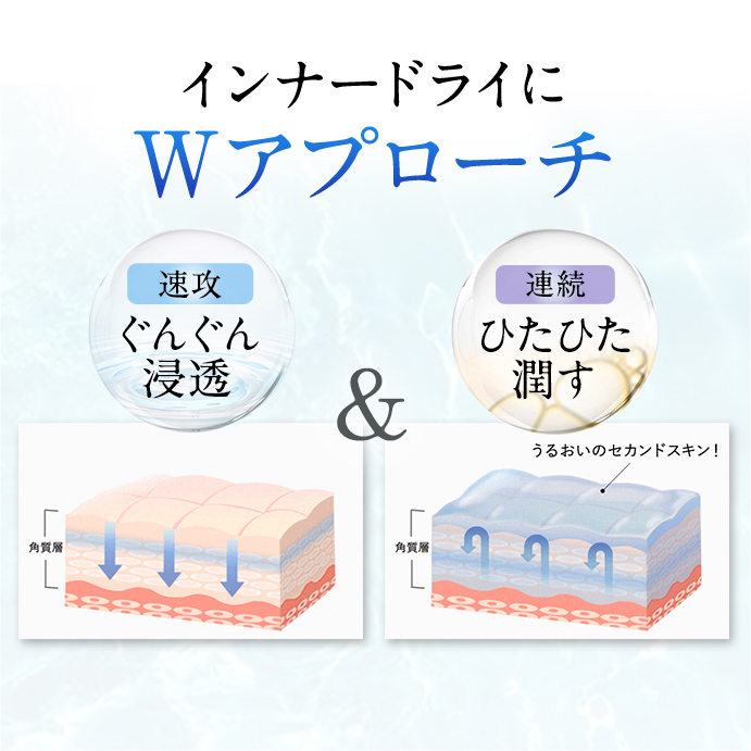 インナードライへのWアプローチのイメージ画像