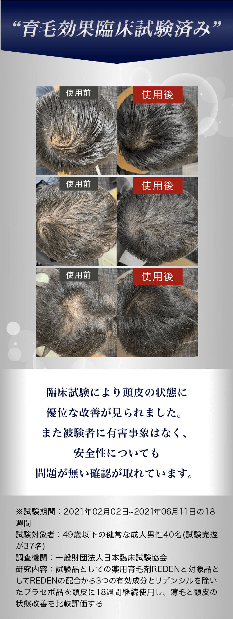 育毛のプロも推薦