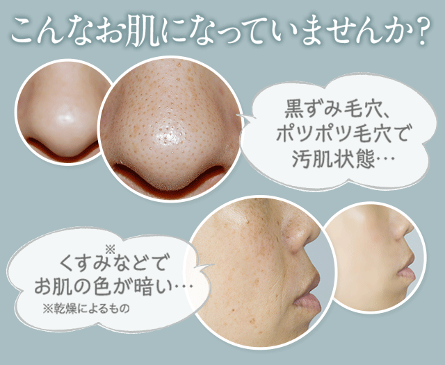 こんなお肌になっていませんか?