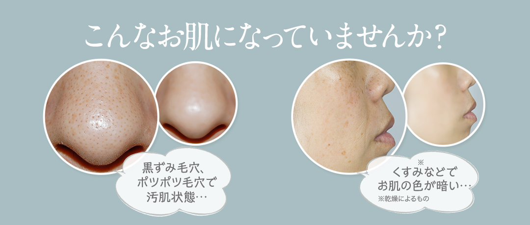 こんなお肌になっていませんか?