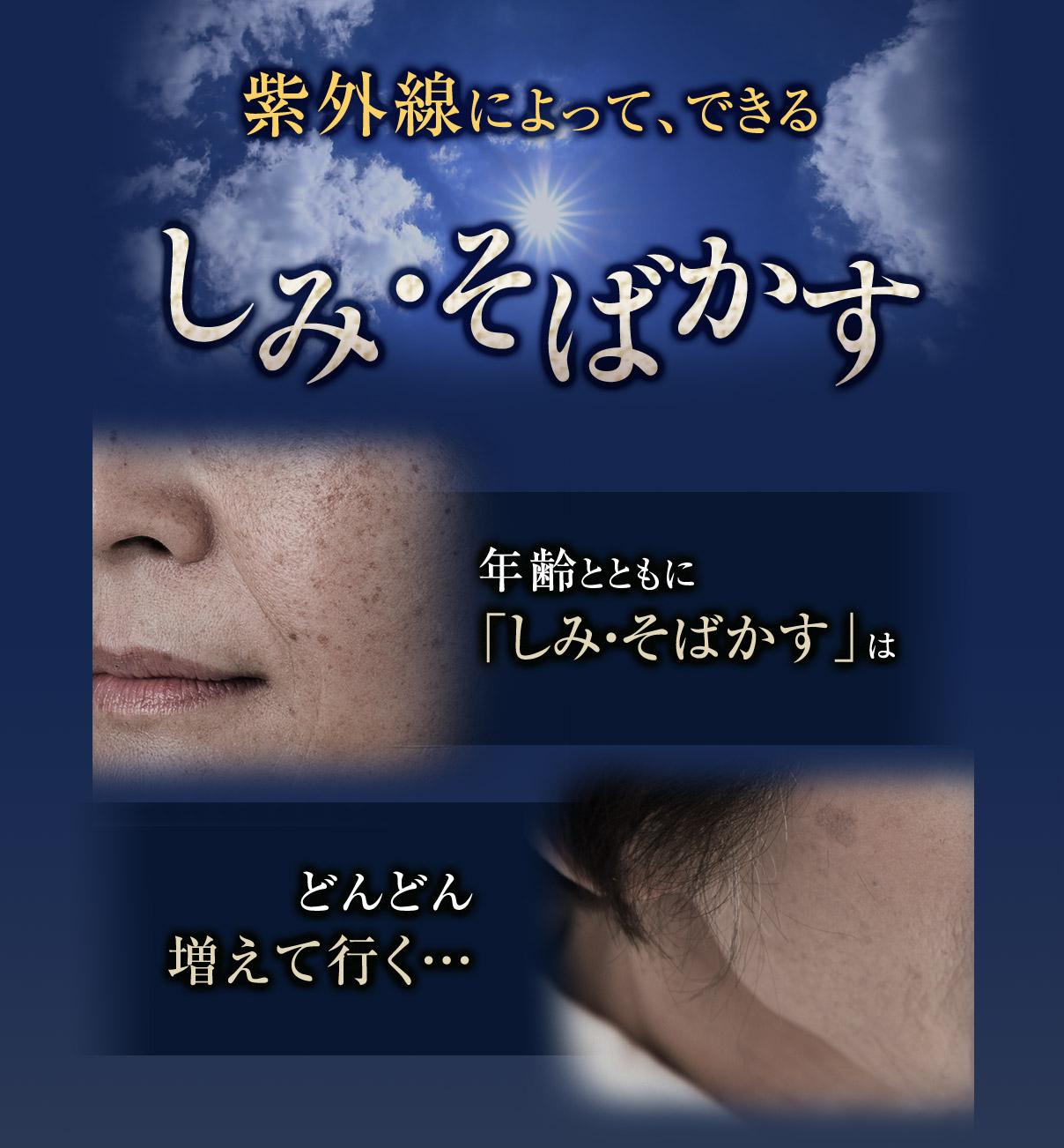 紫外線によって、できるしみ・そばかす