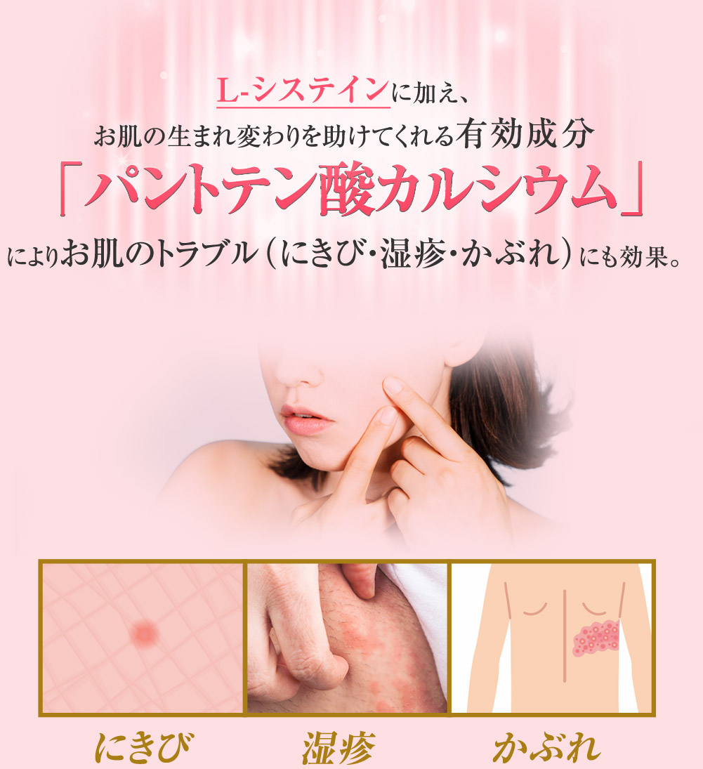 L-システインに加え、お肌の生まれ変わりを助けてくれる有効成分「パントテン酸カルシウム」によりお肌のトラブル(にきび・湿疹・かぶれ)にも効果。